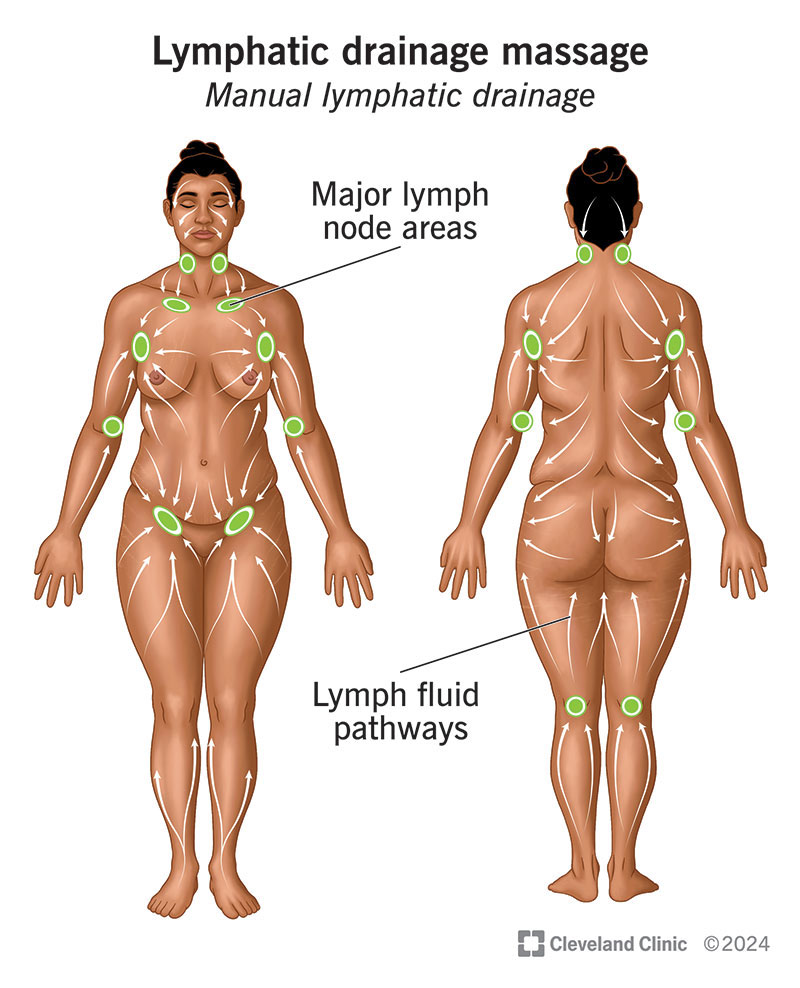 Initial Post Operative or Medical Consult – Lymphatic Drainage