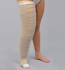 Lymphedema Short-Stretch Compression Bandaging Session